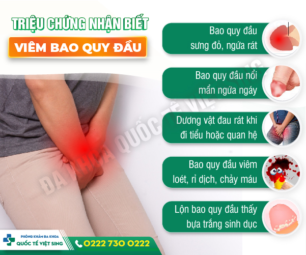 Phù nề bao quy đầu – Nam giới cẩn thận mắc bệnh nam khoa!