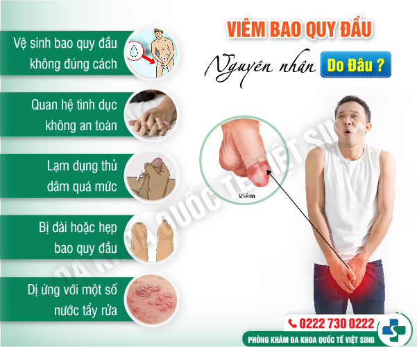 Bác sĩ Nam học chia sẻ về bệnh viêm bao quy đầu và cách chữa hiệu quả