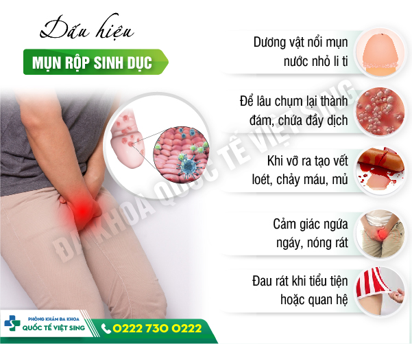 Nhận biết các triệu chứng đặc trưng của bệnh mụn rộp sinh dục ở vùng kín