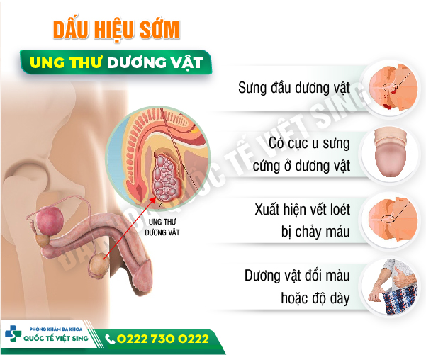 Cảnh báo: 90% trường hợp dương vật bị sưng do bệnh lý gây ra