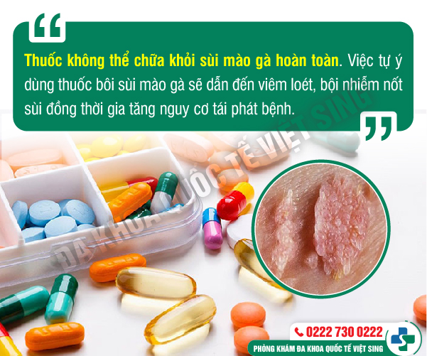 Review công tâm và chi tiết các phương pháp chữa sùi mào gà hiện nay