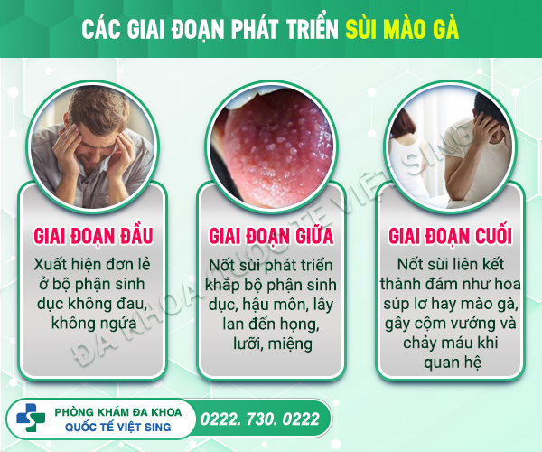 Sùi mào gà lây truyền như thế nào? Làm gì để phát hiện bệnh chính xác nhất?