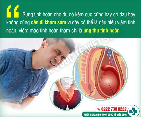 https://phongkhamdakhoavietsing.vn/wp-content/uploads/2023/06/sung-tinh-hoan.jpg