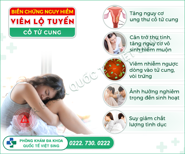 Cảnh báo những biến chứng nguy hiểm của viêm lộ tuyến cổ tử cung