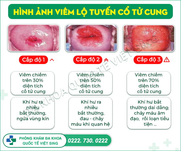 https://phongkhamdakhoavietsing.vn/wp-content/uploads/2023/07/Anh5-1-1.png