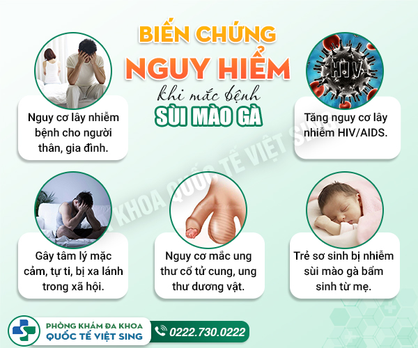 Thực hư về mẹo chữa sùi mào gà tại nhà hiện nay