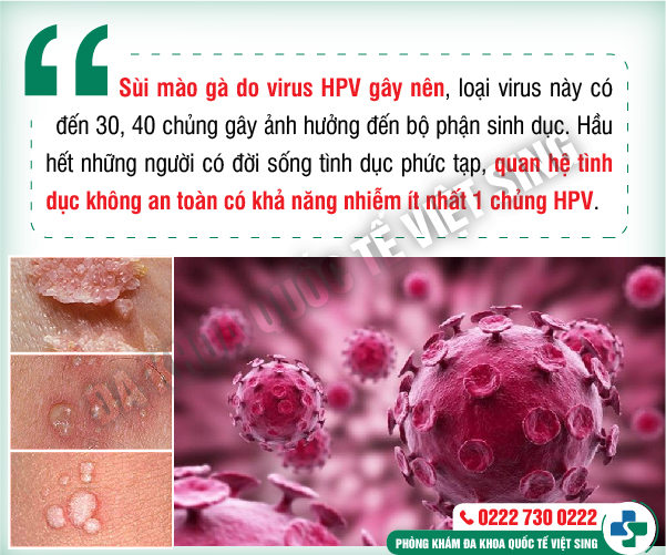 Sùi mào gà có chữa khỏi không? Bác sĩ chuyên khoa giải đáp