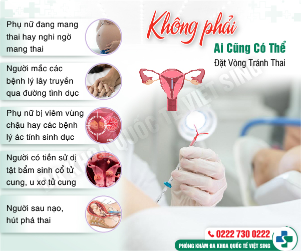 Cấy que tránh thai và một số thông tin quan trọng cần biết