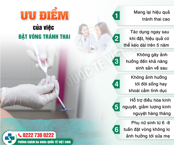 Thời điểm vàng để đặt vòng tránh thai – những lưu ý khi đặt vòng