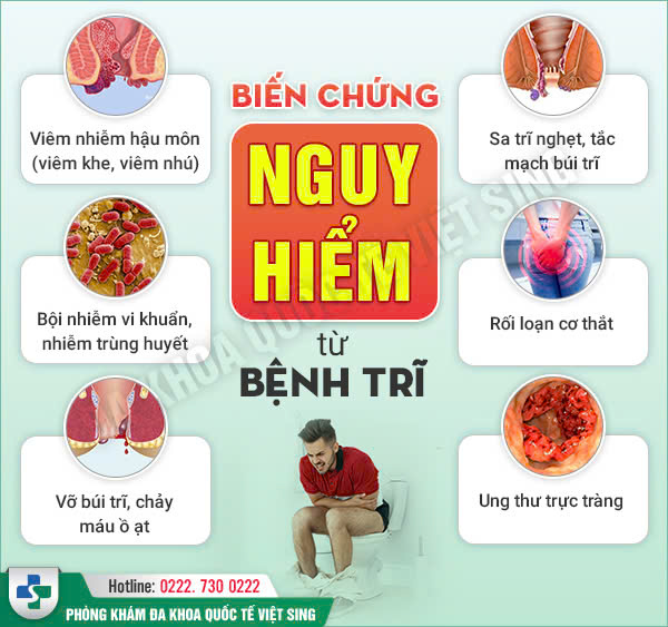 Review top 2 địa chỉ khám chữa bệnh trĩ tốt nhất tại tỉnh Bắc Ninh