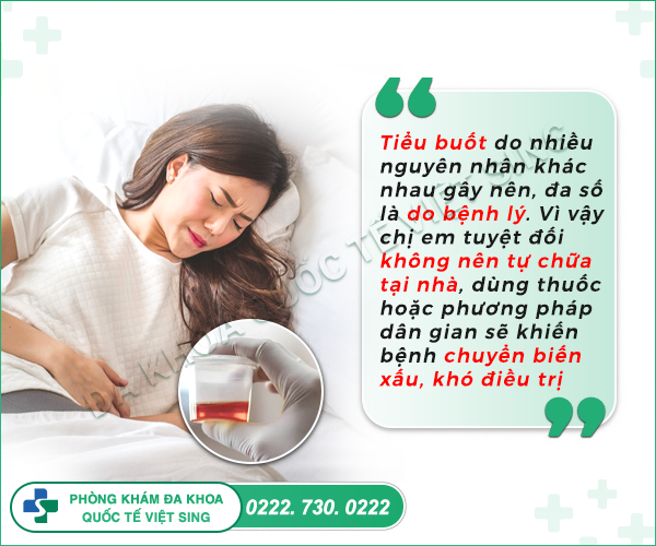 Tiểu buốt tiểu rắt nữ là bệnh gì? Cách chữa ra sao?