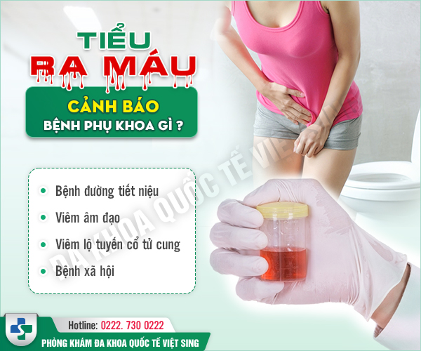 Nữ giới tiểu buốt ra máu có chắc là nhiễm trùng đường tiết niệu?