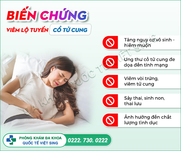 5 bước chữa viêm lộ tuyến cổ tử cung chuẩn Y khoa bằng sóng cao tần ITC