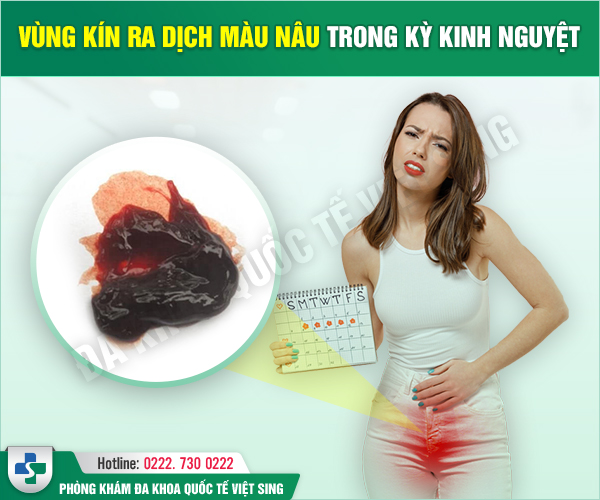 Giải đáp: Ra dịch màu nâu từ vùng kín là bị làm sao?