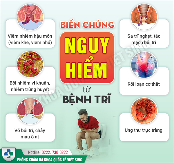 Cắt trĩ nội bằng phương pháp nào tối ưu về thời gian hồi phục và tiết kiệm chi phí?