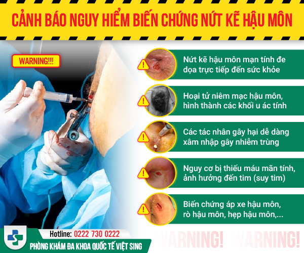 Bác sĩ chuyên khoa đề cao phương pháp điều trị nứt kẽ hậu môn nào?