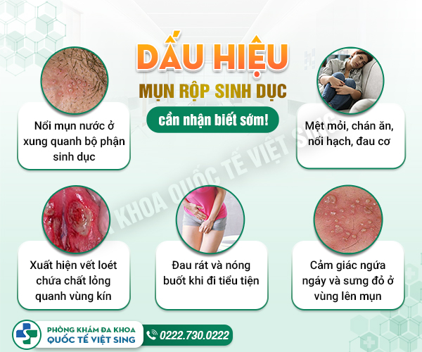 Mụn rộp sinh dục có nguy hiểm không? Đâu là phương pháp chữa bệnh hiệu quả?