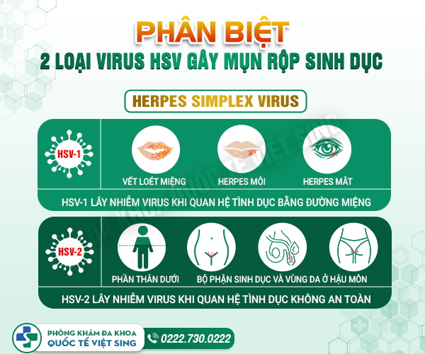 Mụn rộp sinh dục do đâu? Điều trị như thế nào để hạn chế tái phát