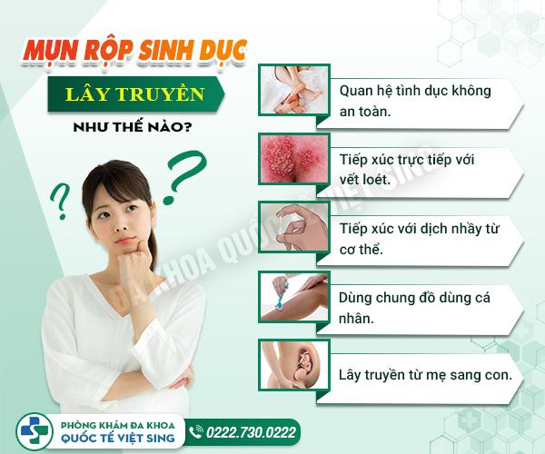Dấu hiệu mụn rộp sinh dục nữ cần lưu ý để điều trị đúng cách