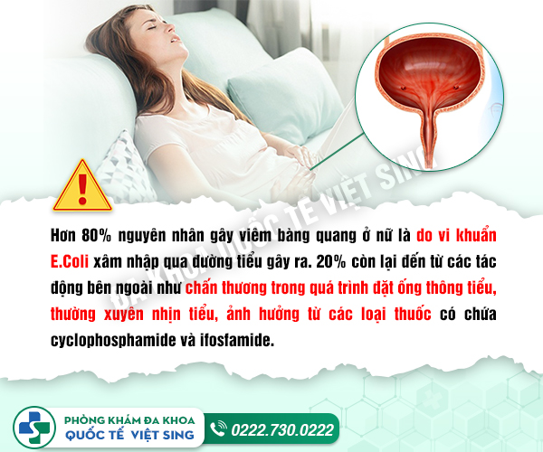 Toàn bộ thông tin về viêm bàng quang ở nữ từ A-Z