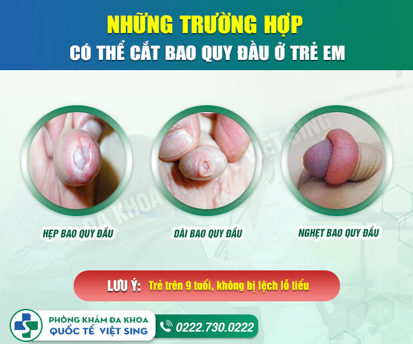 Cắt bao quy đầu ở trẻ có thật sự cần thiết hay không?
