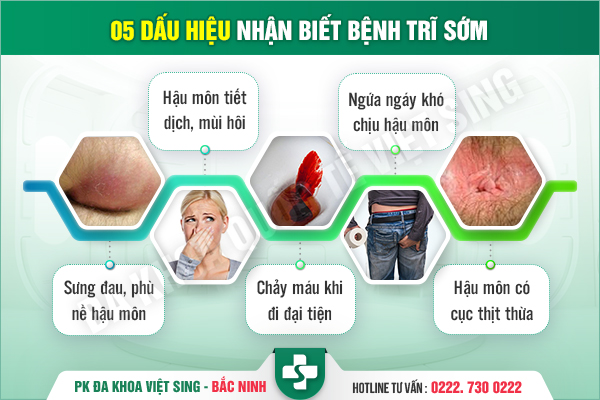 Review top 6 địa chỉ khám chữa bệnh trĩ tốt nhất tại tỉnh Bắc Ninh
