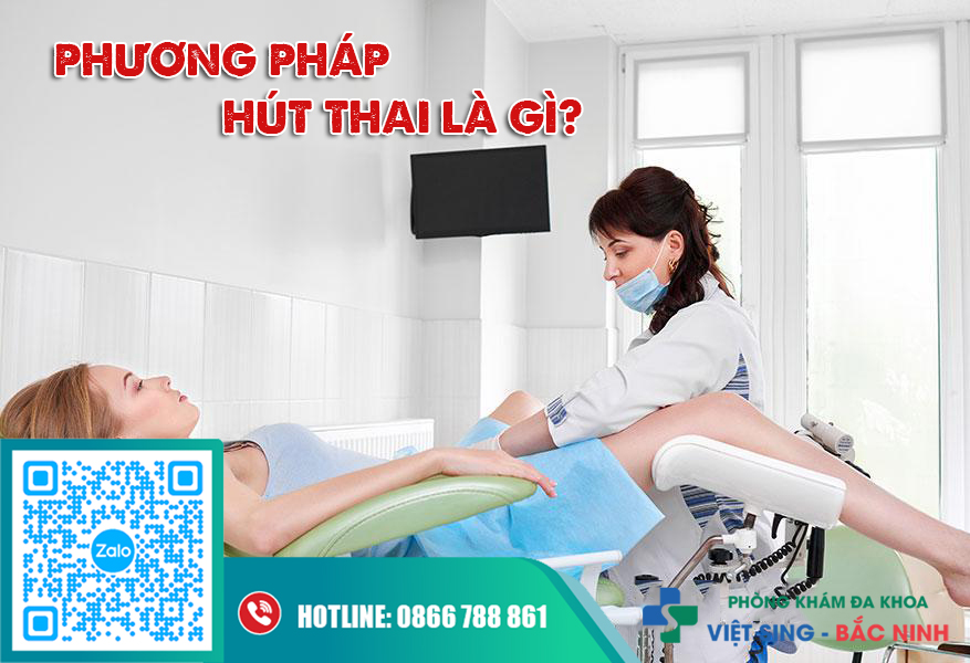 Hút thai chân không là phương pháp như thế nào