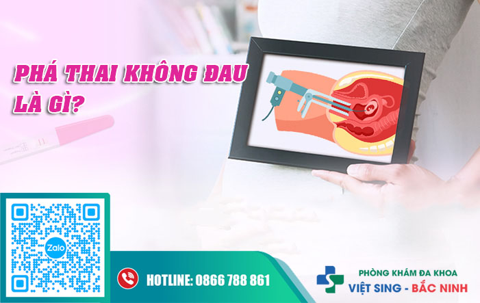 Phá thai không đau