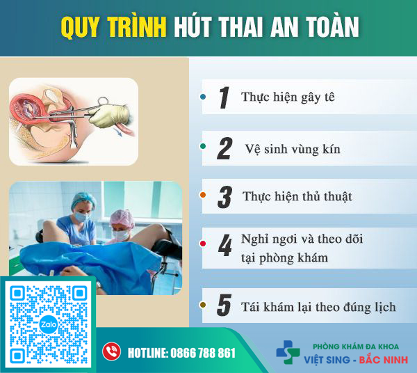 Quy trình hút thai không đau