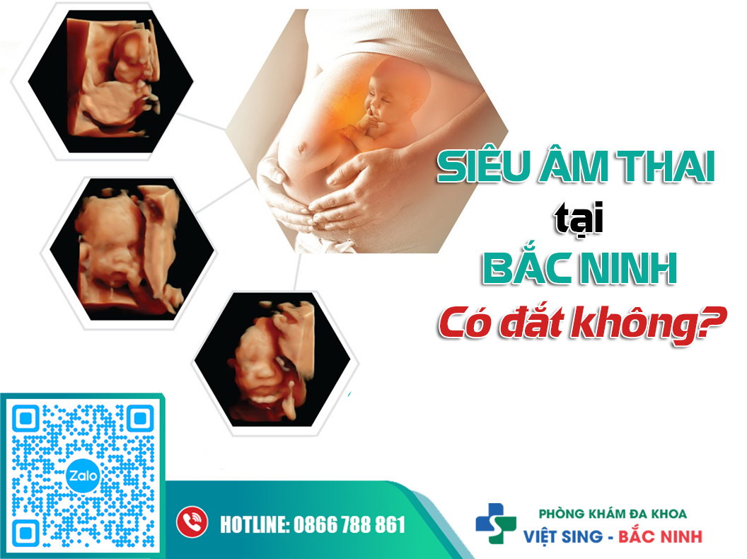 Siêu âm thai tại Bắc Ninh có đắt không?