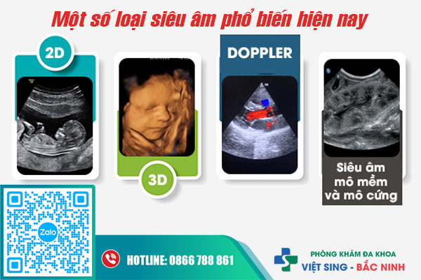 Một số loại siêu âm thai phổ biến hiện nay