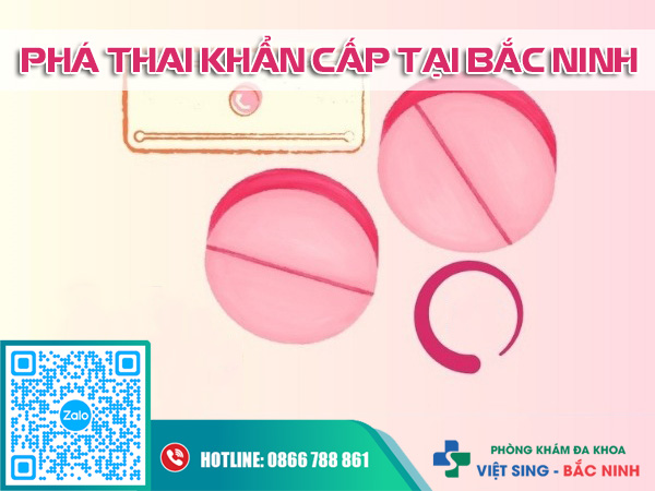 https://phongkhamdakhoavietsing.vn/wp-content/uploads/2025/10/pha-thai-khan-cap-tai-Bac-Ninh.jpg