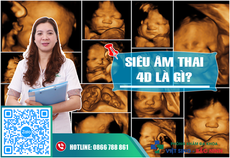 Có phòng siêu âm thai 4D tại Bắc Ninh không?