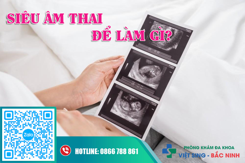 Siêu âm thai để làm gì?