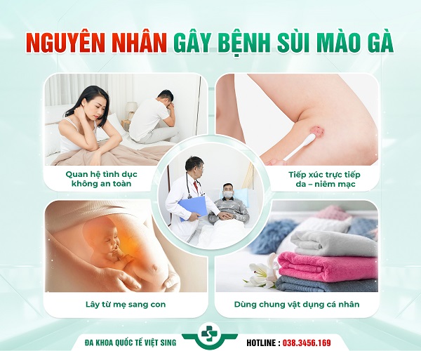 Tổng quan bệnh sùi mào gà: Dấu hiệu, nguyên nhân, nguy hại, cách điều trị